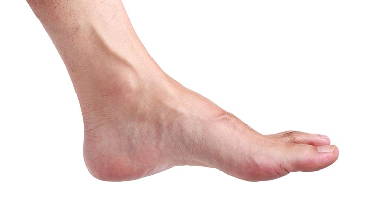 A person's foot, side view.