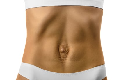 Guide, Physical Therapy Guide to Diastasis Rectus Abdominis