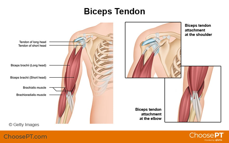 Illustration of biceps tendon attachment.