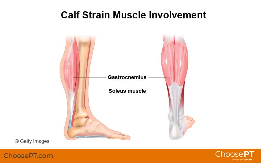 Illustration of the muscles involved in calf strains