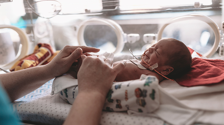 A premature infant in an intensive care unit