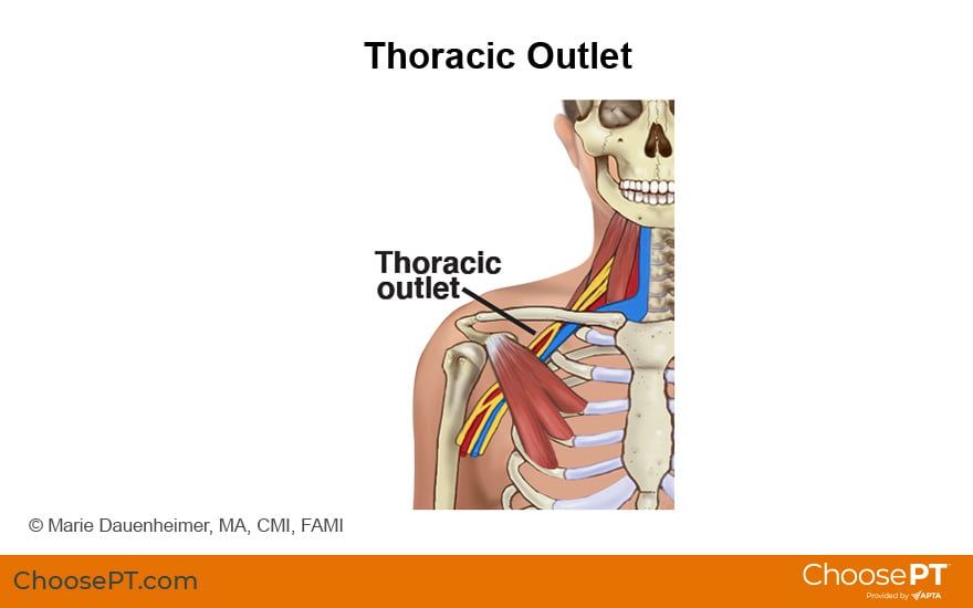 Illustration of the Thoracic Outlet