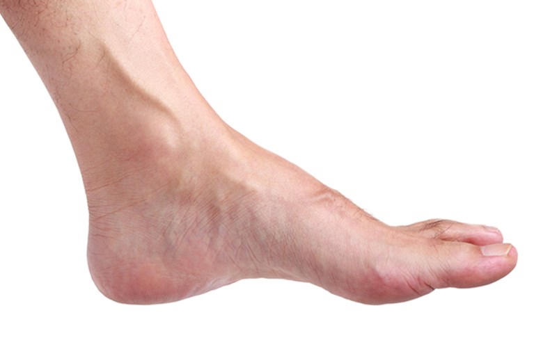 A person's foot, side view.