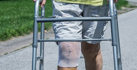 An older adult doing physical activity and exercise after knee replacement surgery using a walker.