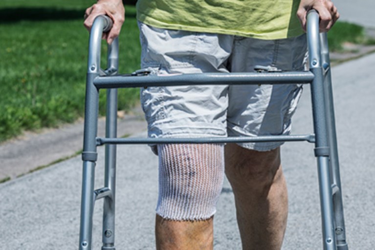 An older adult doing physical activity and exercise after knee replacement surgery using a walker.