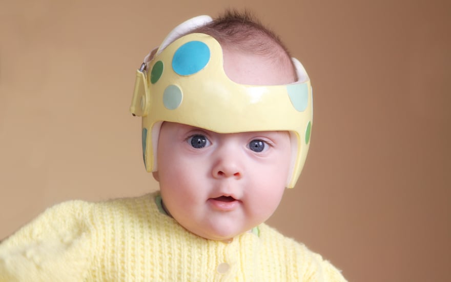 Guide | Physical Therapy Guide to Head-Shape Flatness in Infants